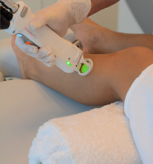 Waarom de Clarity II laser voor laserontharing een sterke keuze is