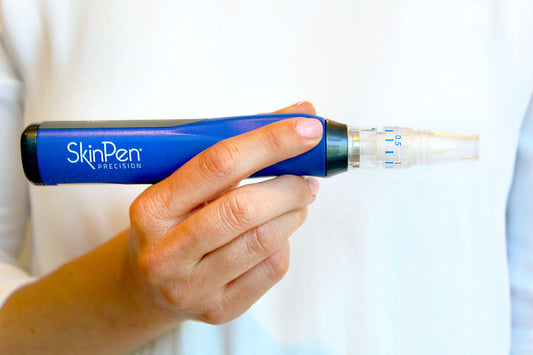 Actie: 3x microneedling kopen = 10% korting